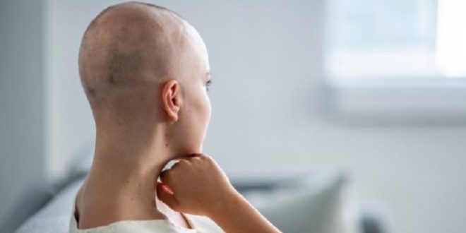 alopecia - tumore